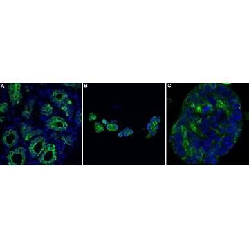 Anti-Cytokeratin 18 Antibody, clone 1G20 ZooMAb® Rabbit Monoclonal，4X25UL，ZRB1727-4X25UL，Sigma