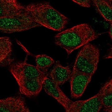 Anti-SIX3 antibody produced in rabbit，100UL，HPA067988-100UL，Sigma