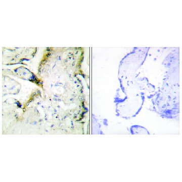 Anti-LAMA2 antibody produced in rabbit，100UG，SAB4501715-100UG，Sigma