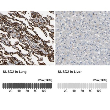 Anti-SUSD2 antibody produced in rabbit，100UL，HPA004117-100UL，Sigma