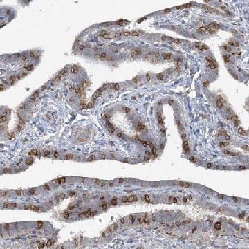 Anti-CDS1 antibody produced in rabbit，100UL，HPA036187-100UL，Sigma