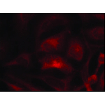 Anti-RAC1 (Ab-71) antibody produced in rabbit，100UG，SAB4300461-100UG，Sigma