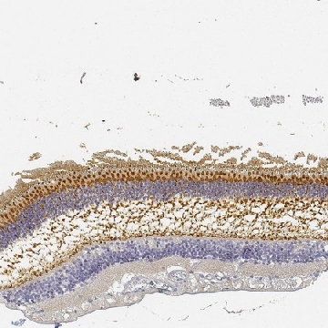 Anti-RP1 antibody produced in rabbit，100UL，HPA042257-100UL，Sigma