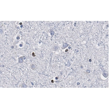 Anti-Olig2 Antibody, clone 211F1.1 ZooMAb® Mouse Monoclonal，4X25UL，ZMS1019-4X25UL，Sigma