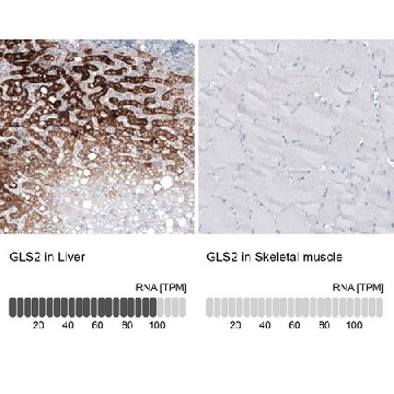 Monoclonal Anti-GLS2 antibody produced in mouse，100UL，AMAB91485-100UL，Sigma