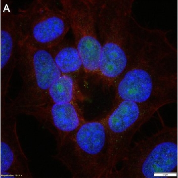 Anti-Phospho-IκBα-Ser32/36 Antibody, clone 1I11 ZooMAb® Rabbit Monoclonal，25UL，ZRB1665-25UL，Sigma