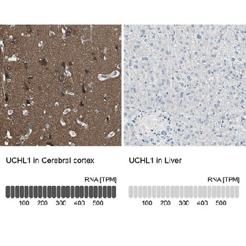 Anti-UCHL1 antibody produced in rabbit，100UL，HPA005993-100UL，Sigma