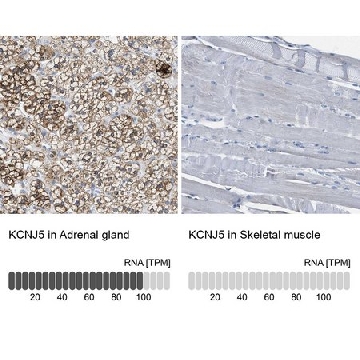 Anti-KCNJ5 antibody produced in rabbit，100UL，HPA017353-100UL，Sigma