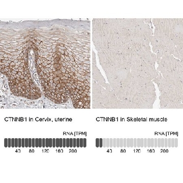 抗-CTNNB1 兔抗，100UL，HPA029159-100UL，Sigma