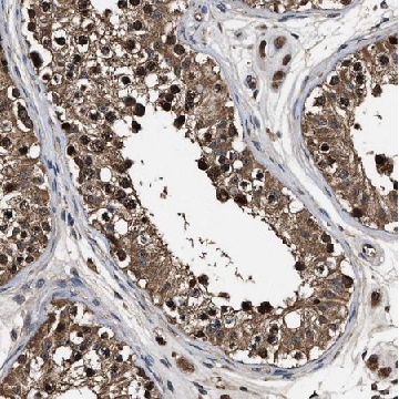 Anti-RNF114 antibody produced in rabbit，100UL，HPA021184-100UL，Sigma