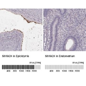 Anti-SMIM24 antibody produced in rabbit，100UL，HPA056027-100UL，Sigma
