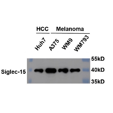 Anti-SIGLEC15 Antibody, clone 1B10 ZooMAb® Rabbit Monoclonal，4X25UL，ZRB2166-4X25UL，Sigma