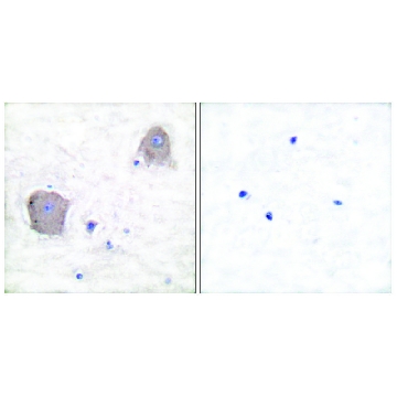 Anti-MGLUR4 antibody produced in rabbit，100UG，SAB4501322-100UG，Sigma