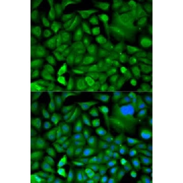 Anti-MIF antibody produced in rabbit，100UL，SAB5700736-100UL，Sigma