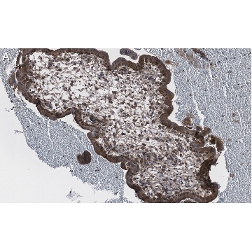 Anti-NF-kB p65 subunit Antibody, clone 1D8 ZooMAb® Rabbit Monoclonal，25UL，ZRB1498-25UL，Sigma