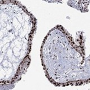 Anti-GSE1 antibody produced in rabbit，100UL，HPA042090-100UL，Sigma
