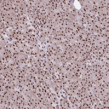 Anti-RIPK3 antibody produced in rabbit，100UL，HPA055087-100UL，Sigma