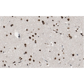 Anti-RNA polymerase II Antibody, clone CTD4H8 ZooMAb® Mouse Monoclonal，4X25UL，ZMS1031-4X25UL，Sigma