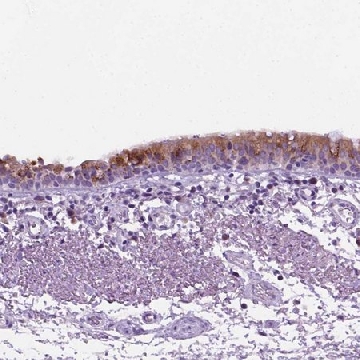 Anti-DNAH11 antibody produced in rabbit，100UL，HPA056474-100UL，Sigma