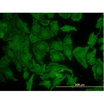 单克隆抗  KRAS 小鼠抗，100UG，WH0003845M1-100UG，Sigma