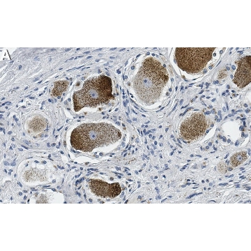 Anti-MRGPRX2 Antibody, clone 1O10 ZooMAb® Rabbit Monoclonal，4X25UL，ZRB2189-4X25UL，Sigma