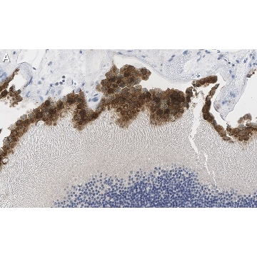 Anti-Bestrophin-1 Antibody, clone E6-6 ZooMAb® Mouse Monoclonal，4X25UL，ZMS1043-4X25UL，Sigma