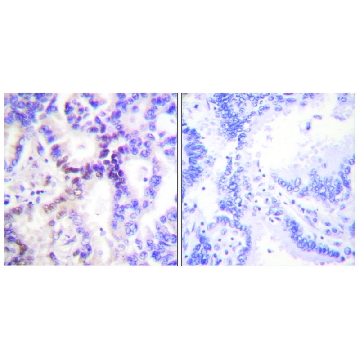 Anti-p15 INK antibody produced in rabbit，100UG，SAB4500078-100UG，Sigma