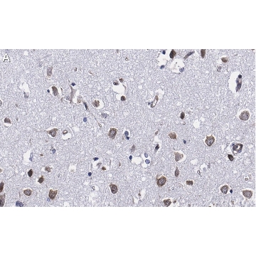 Anti-Ago2 Antibody, clone 2H10 ZooMAb® Rabbit Monoclonal，25UL，ZRB1205-25UL，Sigma