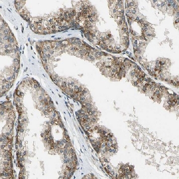 ANTI-LAMTOR1 antibody produced in rabbit，100UL，HPA002997-100UL，Sigma