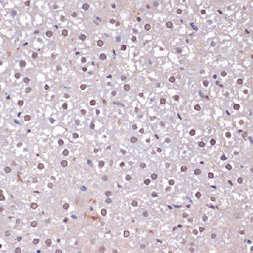 Anti-CDKN2A/p16INK4a antibody produced in rabbit，100UL，SAB5700620-100UL，Sigma