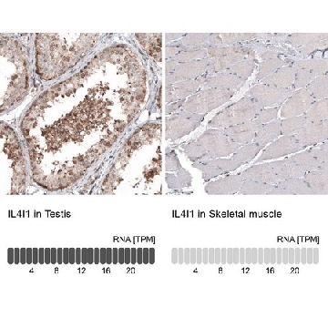 Monoclonal Anti-IL4I1 antibody produced in mouse，100UL，AMAB91560-100UL，Sigma