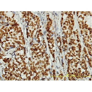 Monoclonal Anti-hCAP-D3 antibody produced in mouse，100UG，WH0023310M1-100UG，Sigma