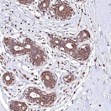 Anti-KLHDC4 antibody produced in rabbit，100UL，HPA041665-100UL，Sigma