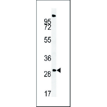 ANTI-ZDHHC21 (N-TERM) antibody produced in rabbit，400UL，SAB1302882-400UL，Sigma