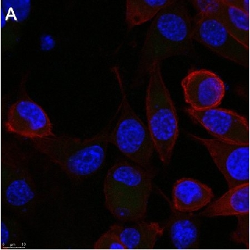 Anti-Rabies glycoprotein Antibody, clone 24-3F-10 ZooMAb® Mouse Monoclonal，25UL，ZMS1046-25UL，Sigma