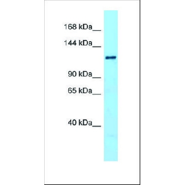 Anti-DENND1A antibody produced in rabbit，100UL，SAB2107278-100UL，Sigma