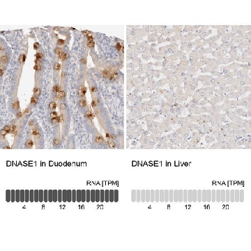 Anti-DNASE1 antibody produced in rabbit，100UL，HPA010703-100UL，Sigma