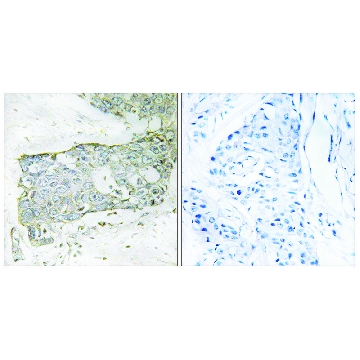Anti-FA7 (light chain, Cleaved-Arg²¹²) antibody produced in rabbit，100UG，SAB4500826-100UG，Sigma