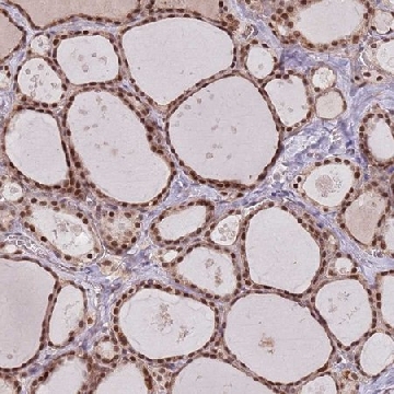 Anti-SUDS3 antibody produced in rabbit，100UL，HPA041972-100UL，Sigma