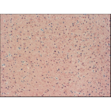 Monoclonal Anti-KCNB2 antibody produced in mouse，100UG，SAB5200064-100UG，Sigma