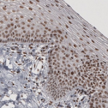 Monoclonal Anti-DAXX antibody produced in mouse，100UL，AMAB91191-100UL，Sigma