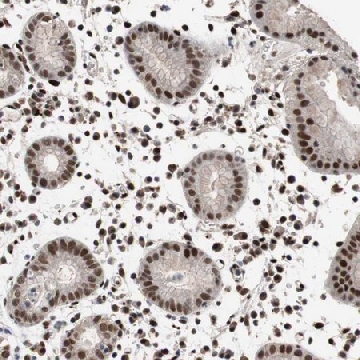 Anti-NBL1 antibody produced in rabbit，100UL，HPA007394-100UL，Sigma