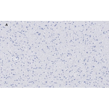 Anti-VGluT1 Antibody, clone 4O15, ZooMAb® Rabbit Monoclonal，25UL，ZRB2374-25UL，Sigma