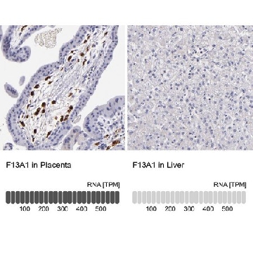 Anti-F13A1 antibody produced in rabbit，100UL，HPA001804-100UL，Sigma