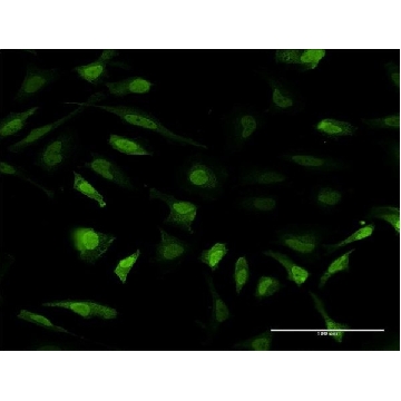 Monoclonal Anti-MT2A antibody produced in mouse，100UG，SAB1402848-100UG，Sigma