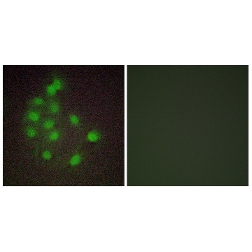 Anti-HAND1 antibody produced in rabbit，100UG，SAB4503639-100UG，Sigma