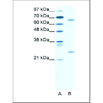 Anti-FOXK2 (AB2) antibody produced in rabbit，100UL，AV100774-100UL，Sigma