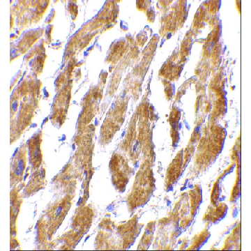 Anti-CRTH2 antibody produced in rabbit，100UG，SAB3500194-100UG，Sigma