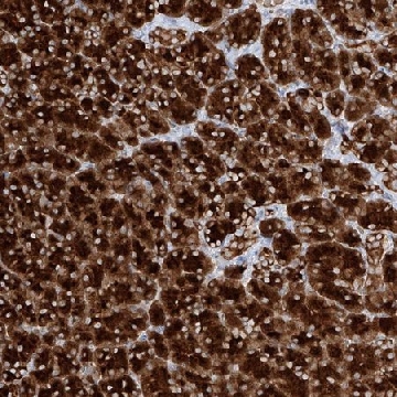 Anti-PPEF1 antibody produced in rabbit，100UL，HPA034577-100UL，Sigma