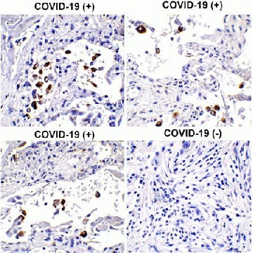 Anti-SARS-CoV-2 (COVID-19) Spike S1 antibody produced in rabbit，100UG，SAB3501119-100UG，Sigma